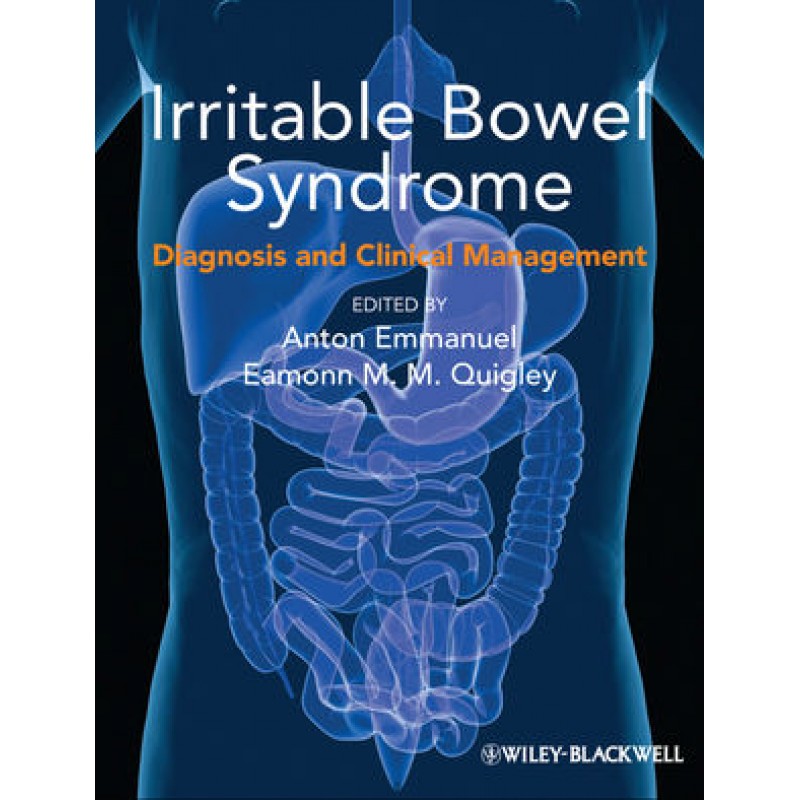 Irritable Bowel Syndrome: Diagnosis and Clinical Management